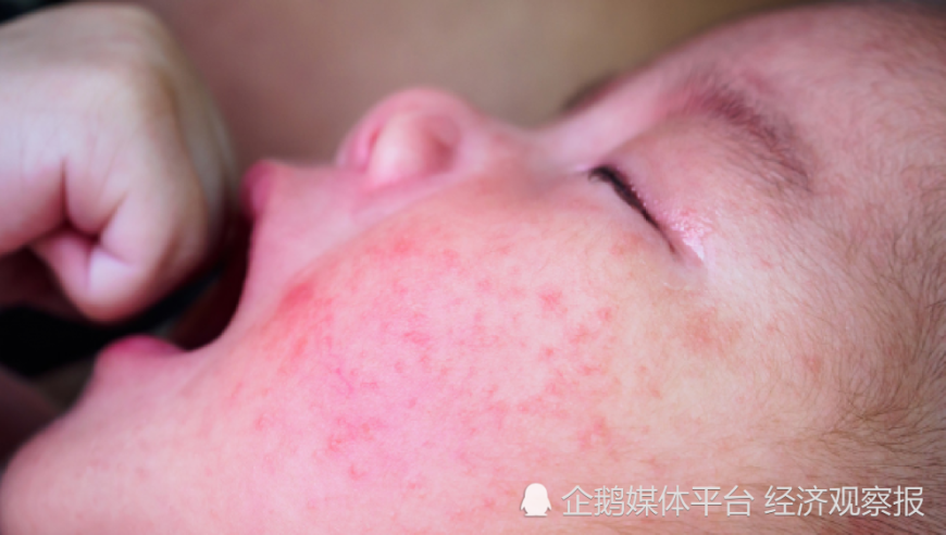 红姐彩色统一图库,孙颖莎嫌黄色衣服晃眼,创造力策略实施推广_基础版V7.56
